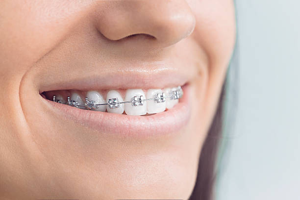 Best Dental Fillings (Composite and Amalgam)  in , KS